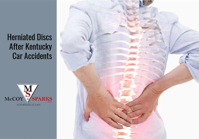 Herniated Discs After Kentucky Car Accidents