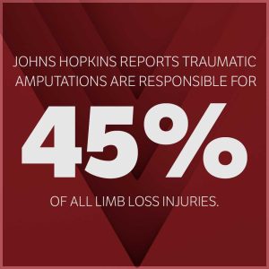 amputation injuries