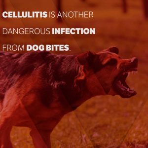 dangerous dog bite infections