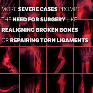 severe cases need surgery