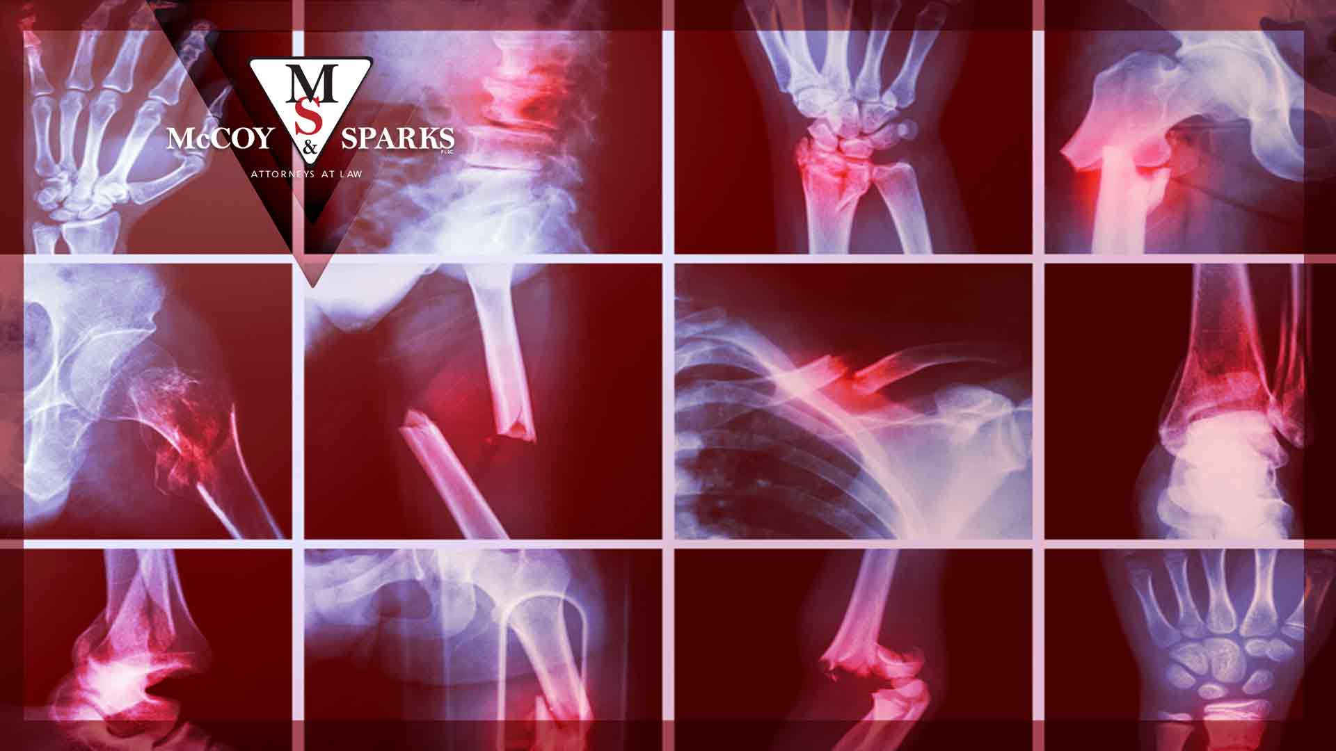 orthopedic injuries