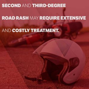 road rash