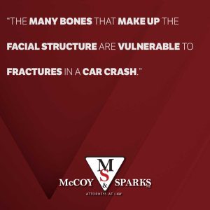 facial fractures